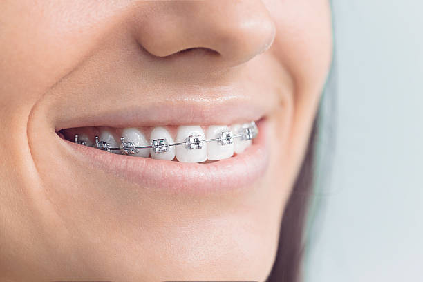 Why Choose Us for Your Dental Needs in Stockton, IL